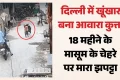 18 माह के बच्चे पर आवारा कुत्ते का हमला: मासूम के चेहरे को नोचा, आईसीयू में भर्ती: CCTV में कैद दर्दनाक घटना