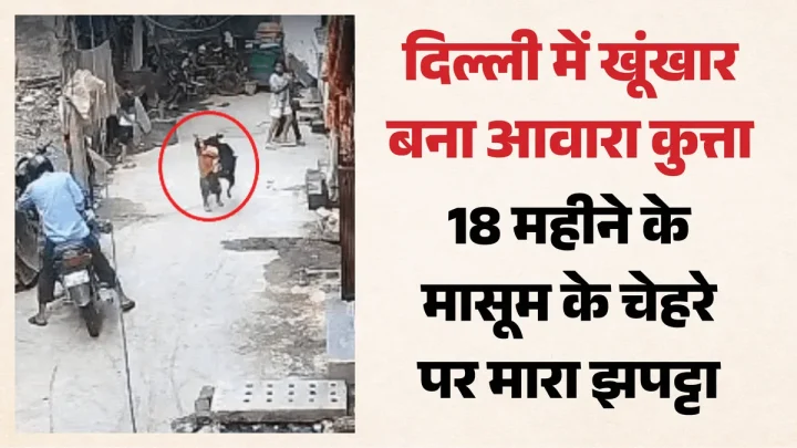 18 माह के बच्चे पर आवारा कुत्ते का हमला: मासूम के चेहरे को नोचा, आईसीयू में भर्ती: CCTV में कैद दर्दनाक घटना